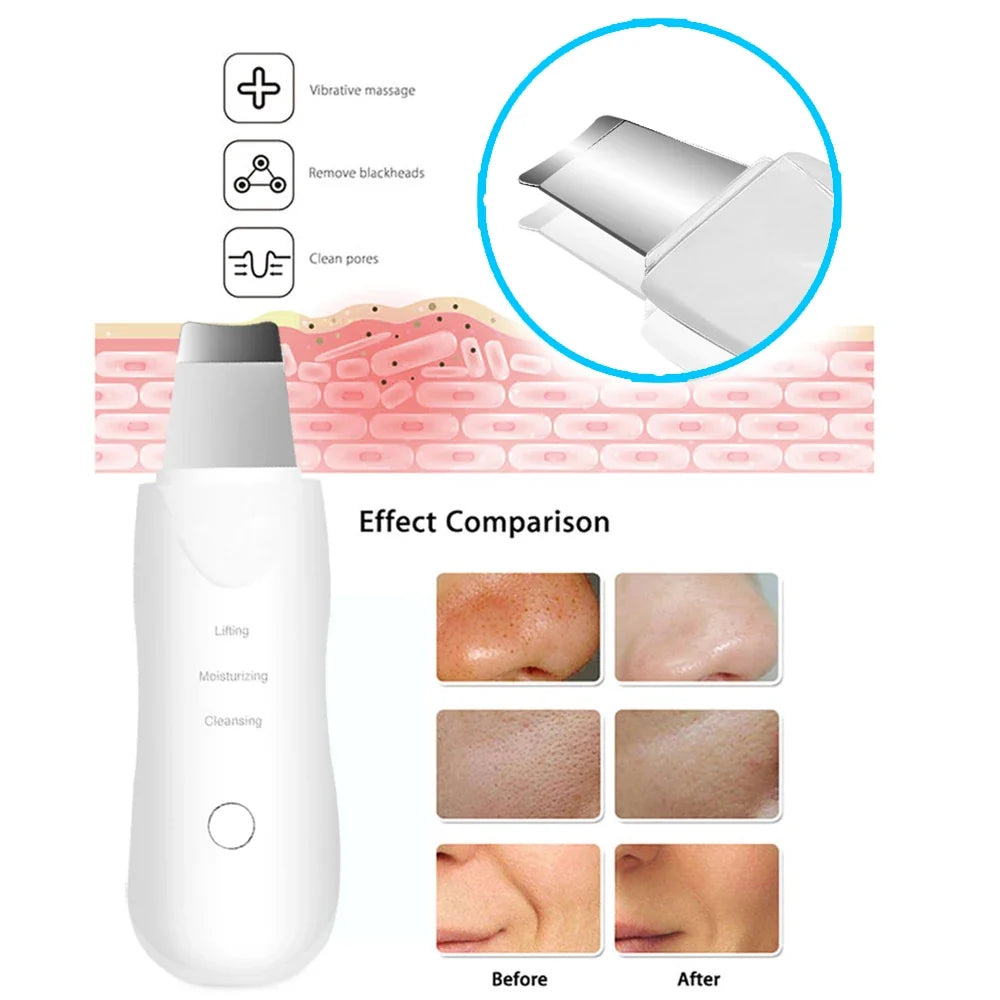 GlowBoost Facial Cleansing Device