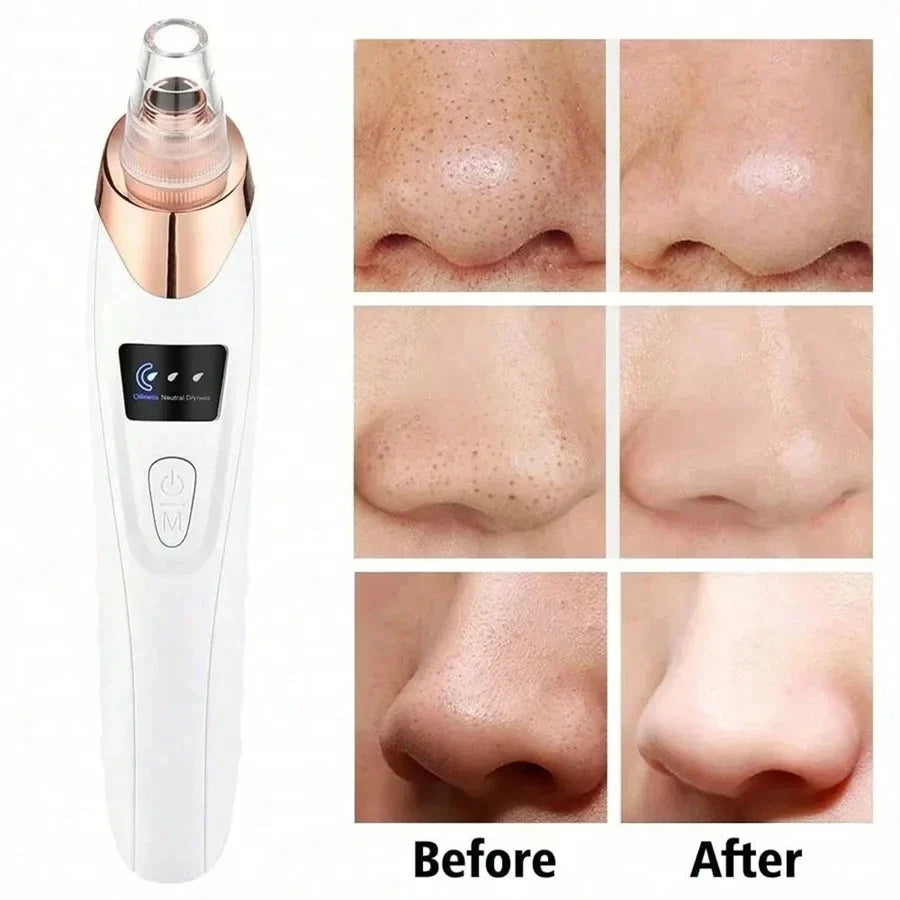 Deep Clean Pore Magic