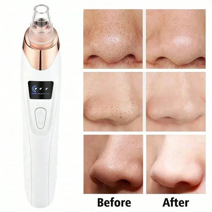 Deep Clean Pore Magic